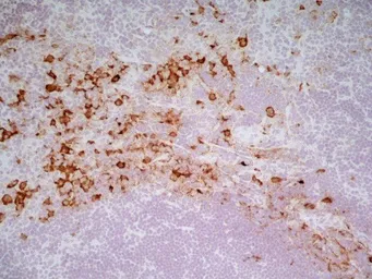 Anti-CD163 antibody [ED2] used in IHC (Frozen sections) (IHC-Fr). GTX42367