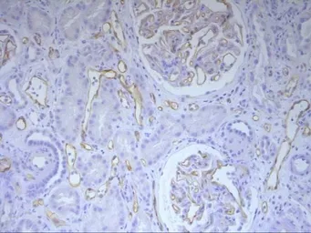 Anti-C4d antibody [10-11] used in IHC (Paraffin sections) (IHC-P). GTX42598