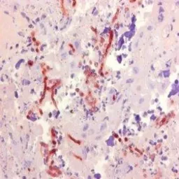 Anti-Aspergillus antibody [WF-AF-1] used in IHC (Paraffin sections) (IHC-P). GTX42724
