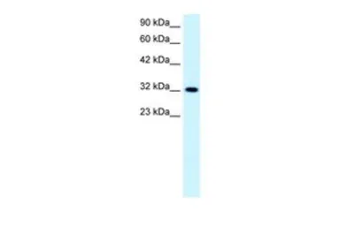 Anti-E2F5 antibody, N-term used in Western Blot (WB). GTX42855