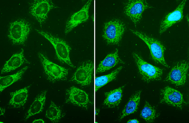 FSD Fluor&trade; Triple-Color (488/594/647) Antibody Labeling Kit. GTX440440