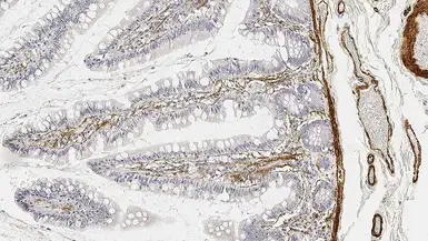 Anti-alpha Smooth Muscle Actin antibody [&#945;sm-1] used in IHC (Paraffin sections) (IHC-P). GTX44499