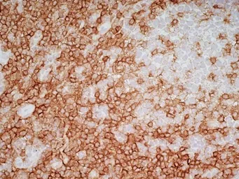 Anti-CD4 antibody [RPA-T4] (Low endotoxin, azide free) used in IHC (Frozen sections) (IHC-Fr). GTX44537