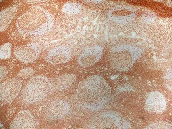 Anti-CD4 antibody [RPA-T4] (Low endotoxin, azide free) used in IHC (Frozen sections) (IHC-Fr). GTX44537