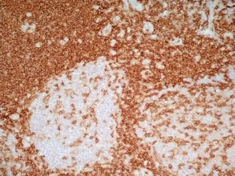 Anti-CD4 antibody [RPA-T4] (Low endotoxin, azide free) used in IHC (Frozen sections) (IHC-Fr). GTX44537