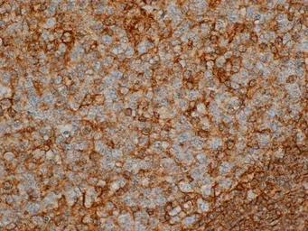 Anti-CD44 antibody [Bu52] used in IHC (Paraffin sections) (IHC-P). GTX44555