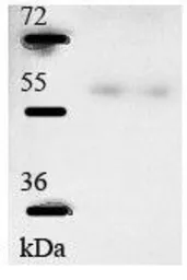 Anti-CLK4 antibody, N-term used in Western Blot (WB). GTX44602