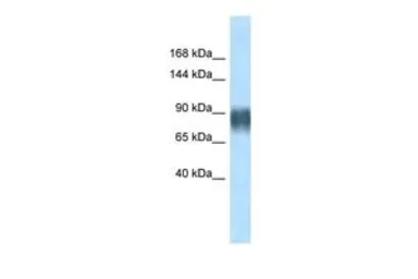Anti-Advillin antibody, N-term used in Western Blot (WB). GTX44605