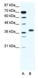Anti-BHLHB5 antibody, N-term used in Western Blot (WB). GTX44609