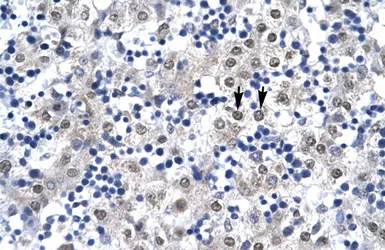 Anti-CDX4 antibody, C-term used in IHC (Paraffin sections) (IHC-P). GTX44611