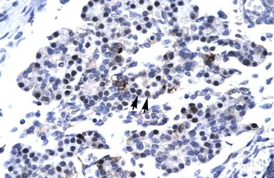 Anti-CDX4 antibody, C-term used in IHC (Paraffin sections) (IHC-P). GTX44611
