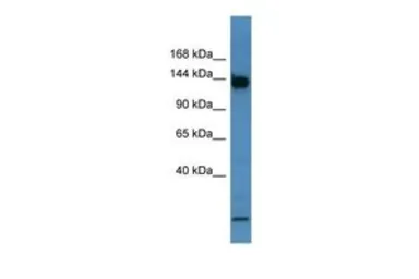 Anti-Basonuclin 1 antibody, C-term used in Western Blot (WB). GTX44618