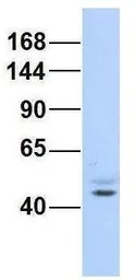 Anti-AFF2 antibody, N-term used in Western Blot (WB). GTX44623