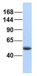 Anti-AFF2 antibody, N-term used in Western Blot (WB). GTX44623