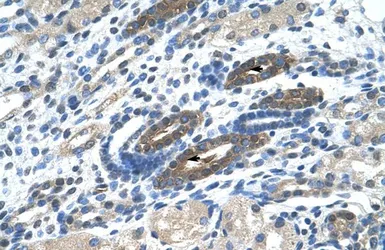 Anti-BTBD14A antibody, N-term used in IHC (Paraffin sections) (IHC-P). GTX44625