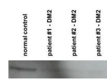 Anti-CNBP antibody, N-term used in Western Blot (WB). GTX44628
