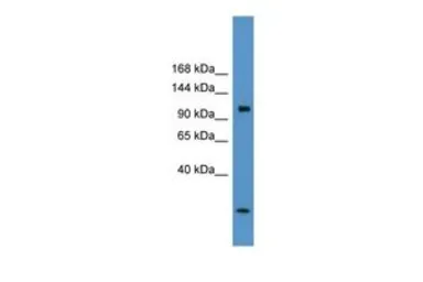 Anti-CLCN1 antibody, C-term used in Western Blot (WB). GTX44629