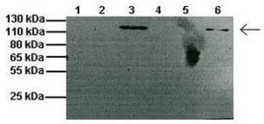 Anti-CLCN1 antibody, C-term used in Western Blot (WB). GTX44629