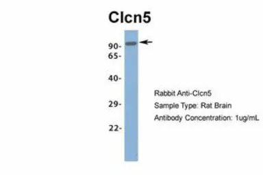 Anti-CLCN5 antibody, Internal used in Western Blot (WB). GTX44630