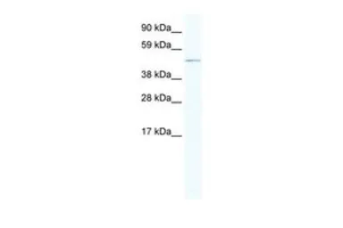 Anti-ARX antibody, Internal used in Western Blot (WB). GTX44640