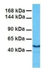 Anti-ARX antibody, Internal used in Western Blot (WB). GTX44640