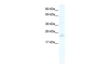 Anti-ASCL2 antibody, C-term used in Western Blot (WB). GTX44645