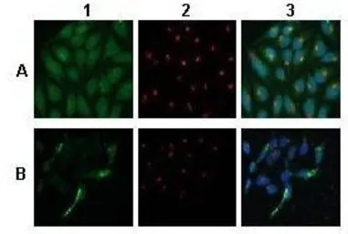 Anti-ATP6V0A1 antibody, C-term used in Immunocytochemistry/ Immunofluorescence (ICC/IF). GTX44653