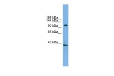 Anti-ATP6V0A1 antibody, C-term used in Western Blot (WB). GTX44653