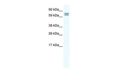 Anti-CES6 antibody, Internal used in Western Blot (WB). GTX44659