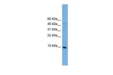 Anti-BOLA2 antibody, N-term used in Western Blot (WB). GTX44662