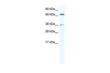 Anti-ALX3 antibody, N-term used in Western Blot (WB). GTX44663