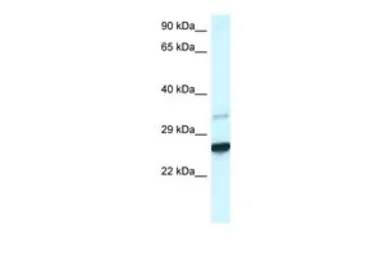 Anti-CDX1 antibody, C-term used in Western Blot (WB). GTX44665