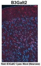 Anti-B3GALT2 antibody, C-term used in IHC (Paraffin sections) (IHC-P). GTX44689