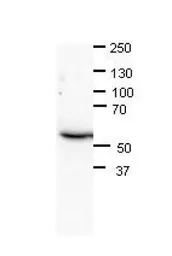 Anti-CHAF1B antibody, N-term used in Western Blot (WB). GTX44690