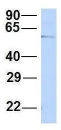 Anti-CHAF1B antibody, N-term used in Western Blot (WB). GTX44690