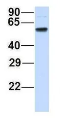 Anti-CHAF1B antibody, N-term used in Western Blot (WB). GTX44690