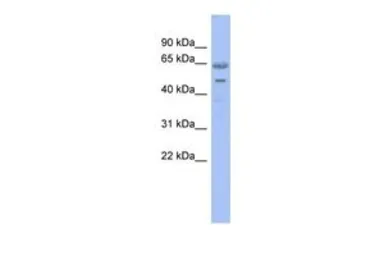 Anti-Nucleostemin antibody, N-term used in Western Blot (WB). GTX44809
