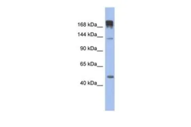 Anti-SLIT3 antibody, N-term used in Western Blot (WB). GTX44818