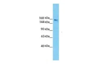 Anti-SLIT3 antibody, N-term used in Western Blot (WB). GTX44818