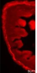 Anti-SLIT1 antibody, Internal used in IHC (Frozen sections) (IHC-Fr). GTX44819
