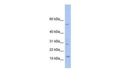 Anti-TD1 antibody, Internal used in Western Blot (WB). GTX44820