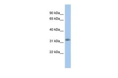 Anti-NGRN antibody, N-term used in Western Blot (WB). GTX44821