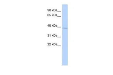 Anti-RP11-217H1.1 antibody, N-term used in Western Blot (WB). GTX44823