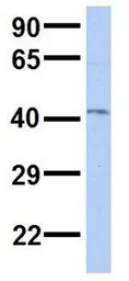 Anti-RP11-217H1.1 antibody, N-term used in Western Blot (WB). GTX44823