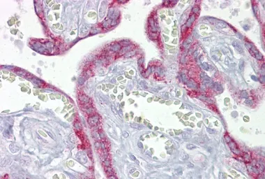 Anti-mtTFA antibody, Internal used in IHC (Paraffin sections) (IHC-P). GTX44824