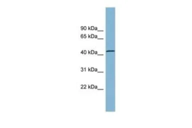 Anti-TBC1D13 antibody, Internal used in Western Blot (WB). GTX44839