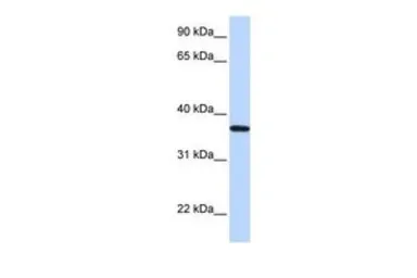 Anti-LCN12 antibody, N-term used in Western Blot (WB). GTX44850