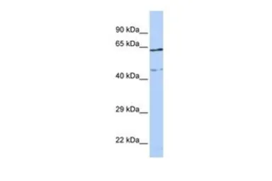 Anti-CCDC74A antibody, Internal used in Western Blot (WB). GTX44852