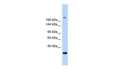 Anti-UTY antibody, Internal used in Western Blot (WB). GTX44867