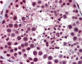 Anti-NASP antibody, Internal used in IHC (Paraffin sections) (IHC-P). GTX44874